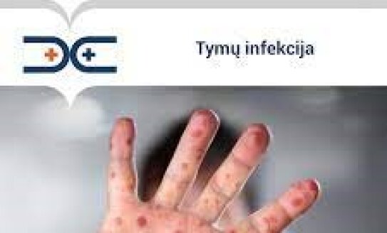 Nacionalinio visuomenės sveikatos centras informuoja apie tymų infekcinę ligą